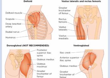 Aplikimi I injeksioneve IM ne muskulin Dorso-Gluteal