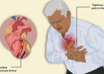 Angina pectoris