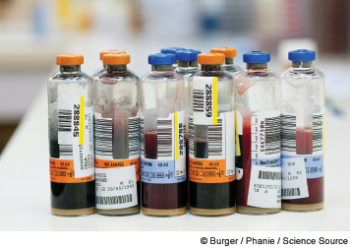 CFARË ËSHTË NJË SISTEM BACT/ALERT DHE HEMOKULTURA?