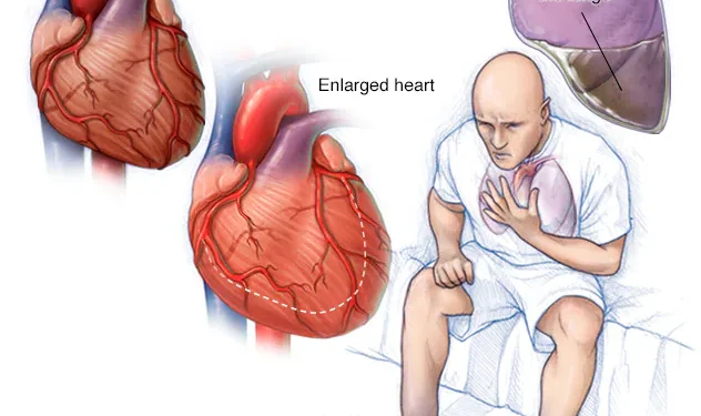 ROLI IINFERMIERIT NE PACIENTET ME INSUFICIENZE KARDIAKE